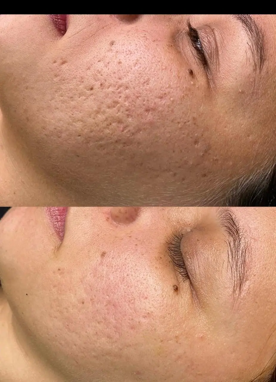 Registro comparativo de evolução de protocolo facial